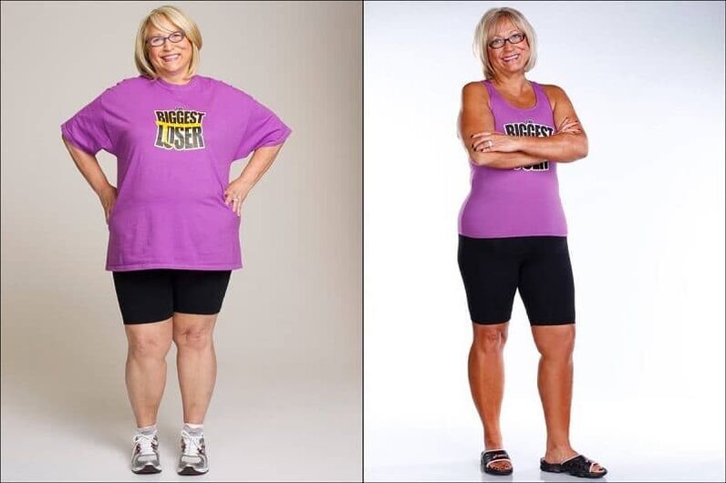 Women before and after weight loss